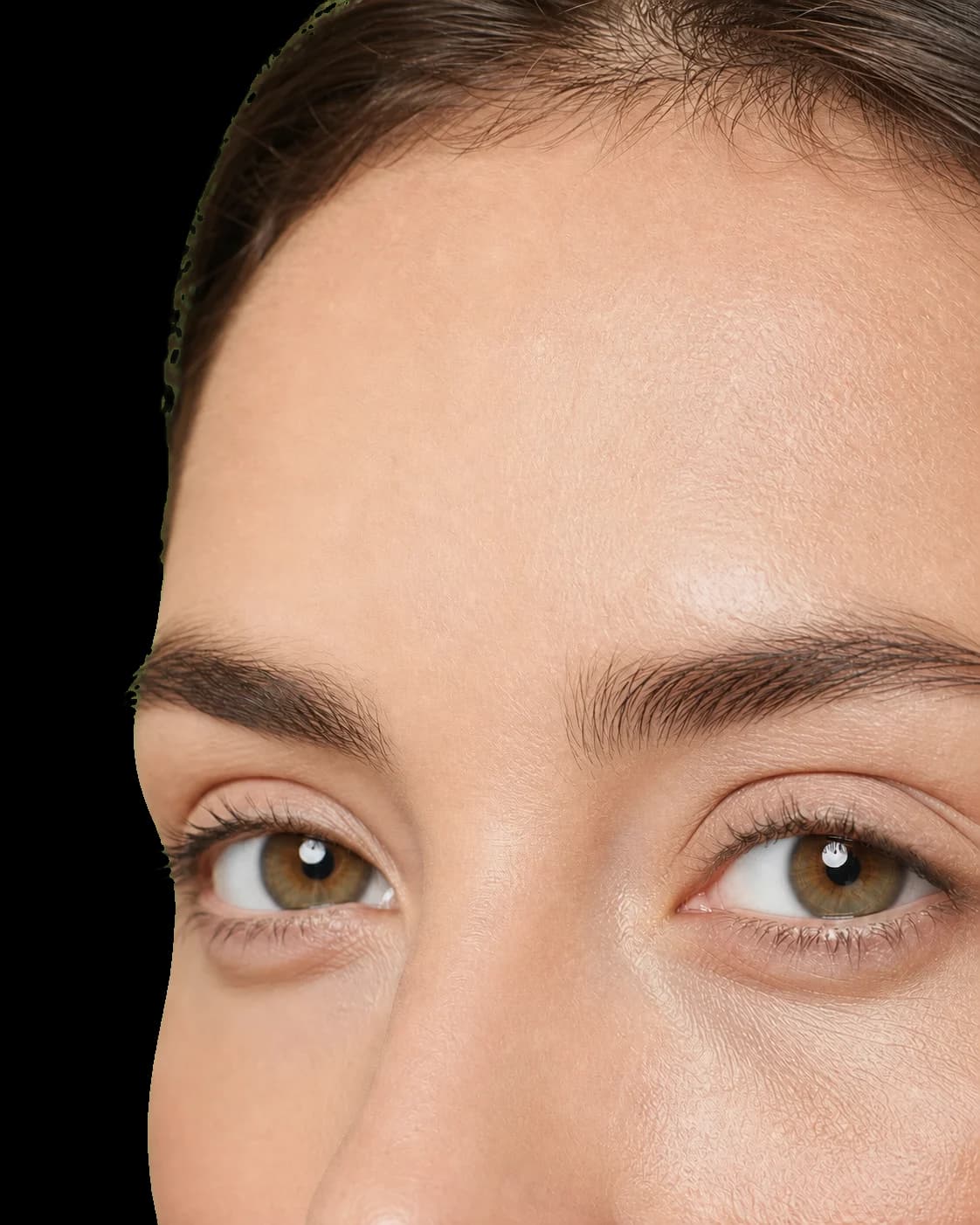 Blefaroplastie superioara si inferioara - Proceduri