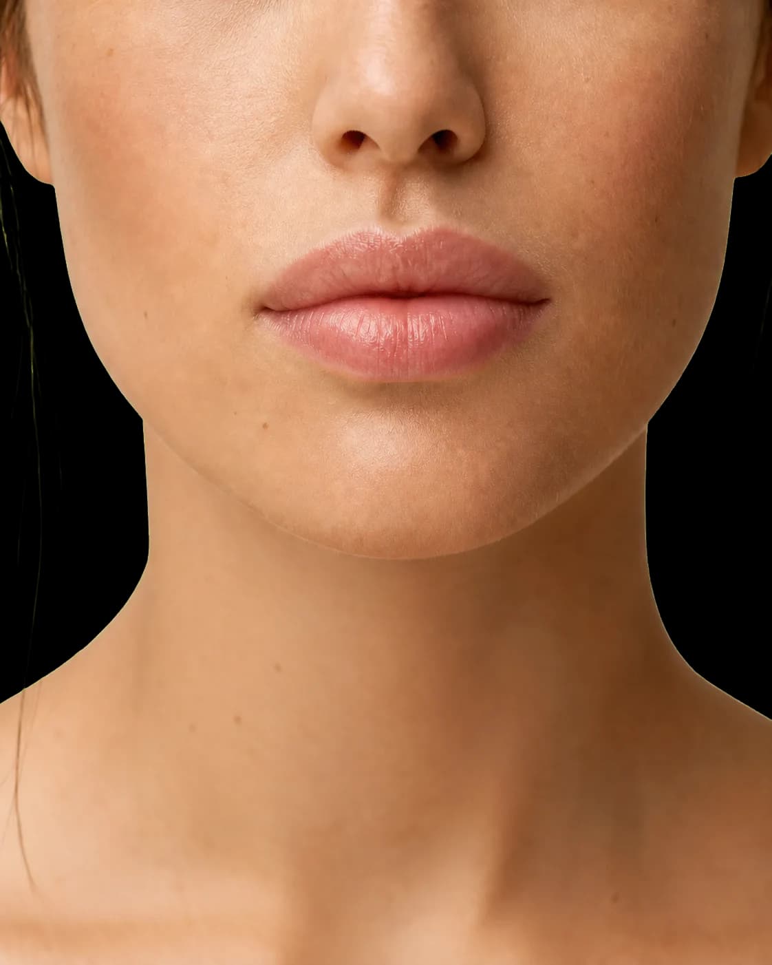 Lipofilling facial - Proceduri