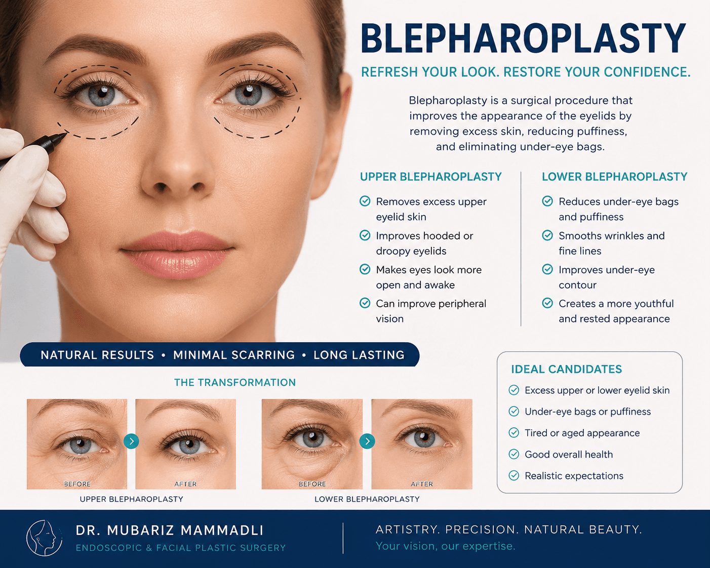 alt= “Blefaroplasty”