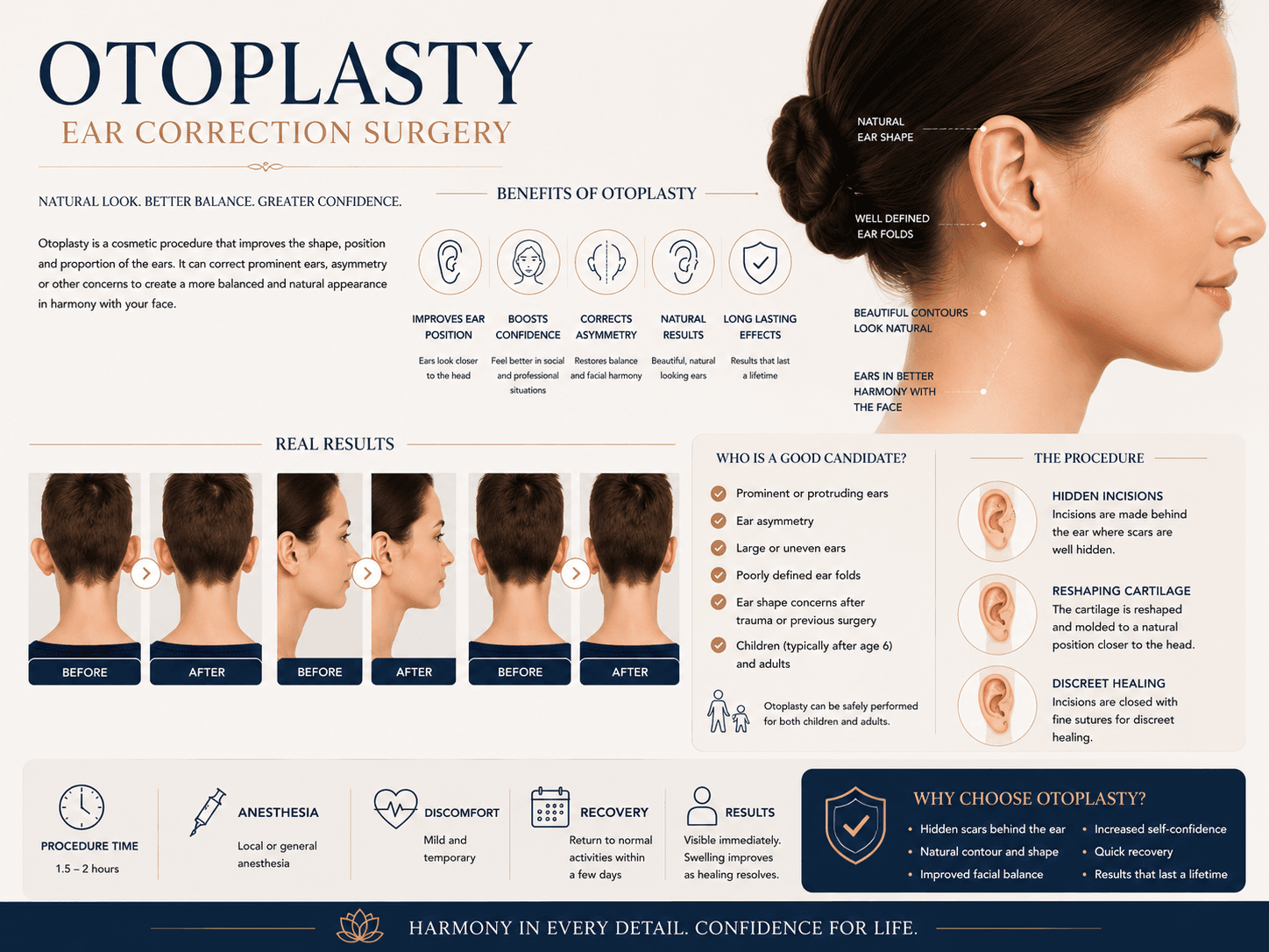 Alt=“otoplasty”