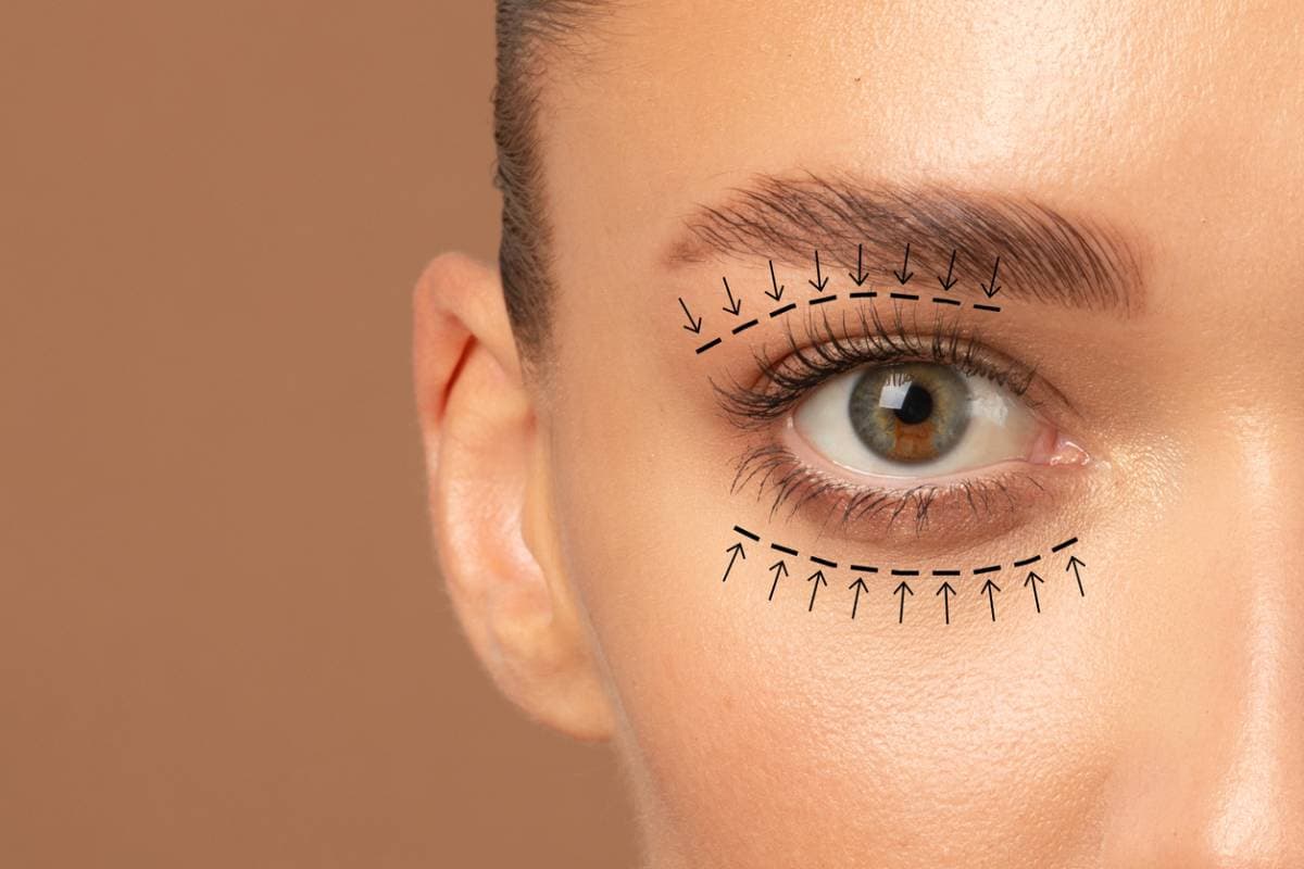 Blefaroplastia, Cirugía del Párpado Inferior, Recuperación, Zona de los Ojos, Cirugía Facial
